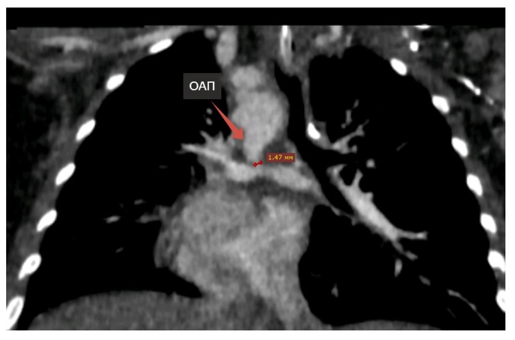 Фото 2. КТ-снимок.jpg